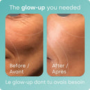 Before and after skin results from taking BioSil collagen generator